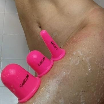 Place Cellicupp® on thighs, butt, belly and more!